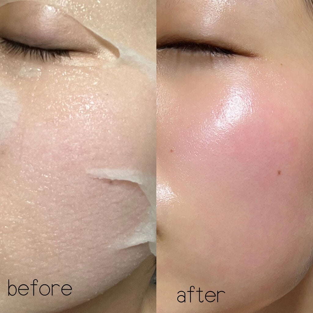 ごめんね素肌マスク/クリアターン/シートマスク・パックを使ったクチコミ(4枚目)