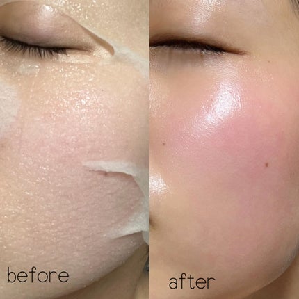 ごめんね素肌マスク/クリアターン/シートマスク・パックを使ったクチコミ(4枚目)