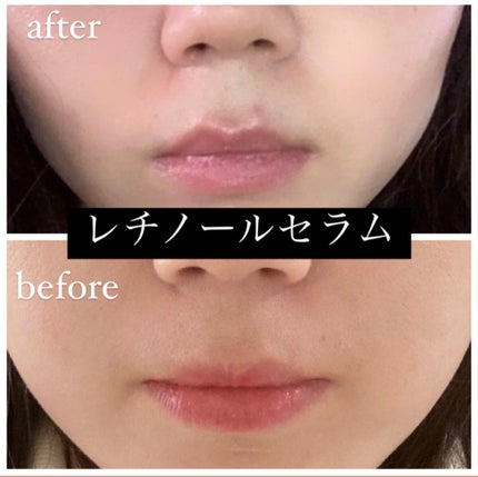 レチノールインテンシブ アドバンスドトリプルアクションアイクリーム/SOME BY MI/アイケア・アイクリームを使ったクチコミ(9枚目)