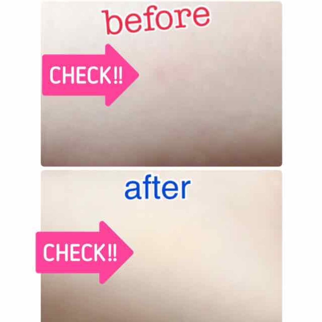 スポッツカバー ファウンデイション/SHISEIDO/クリームコンシーラーを使ったクチコミ（3枚目）