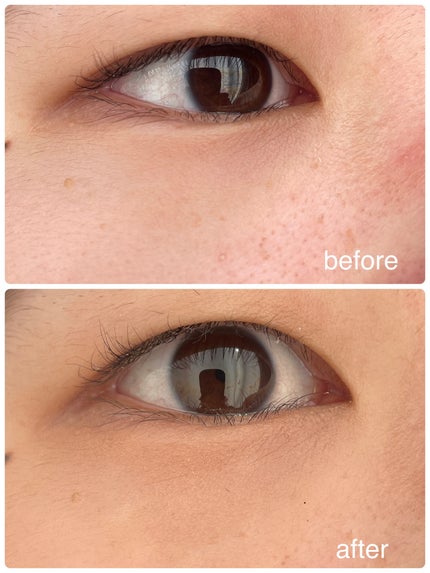 リシェ レッドトリック アイコンシーラー/Visée/パレットコンシーラーを使ったクチコミ(2枚目)