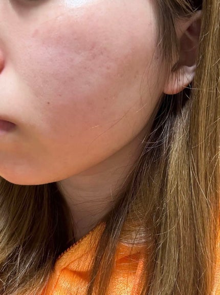 ブラッシュストロークス/ラッシュ/洗い流すパック・マスクを使ったクチコミ(3枚目)