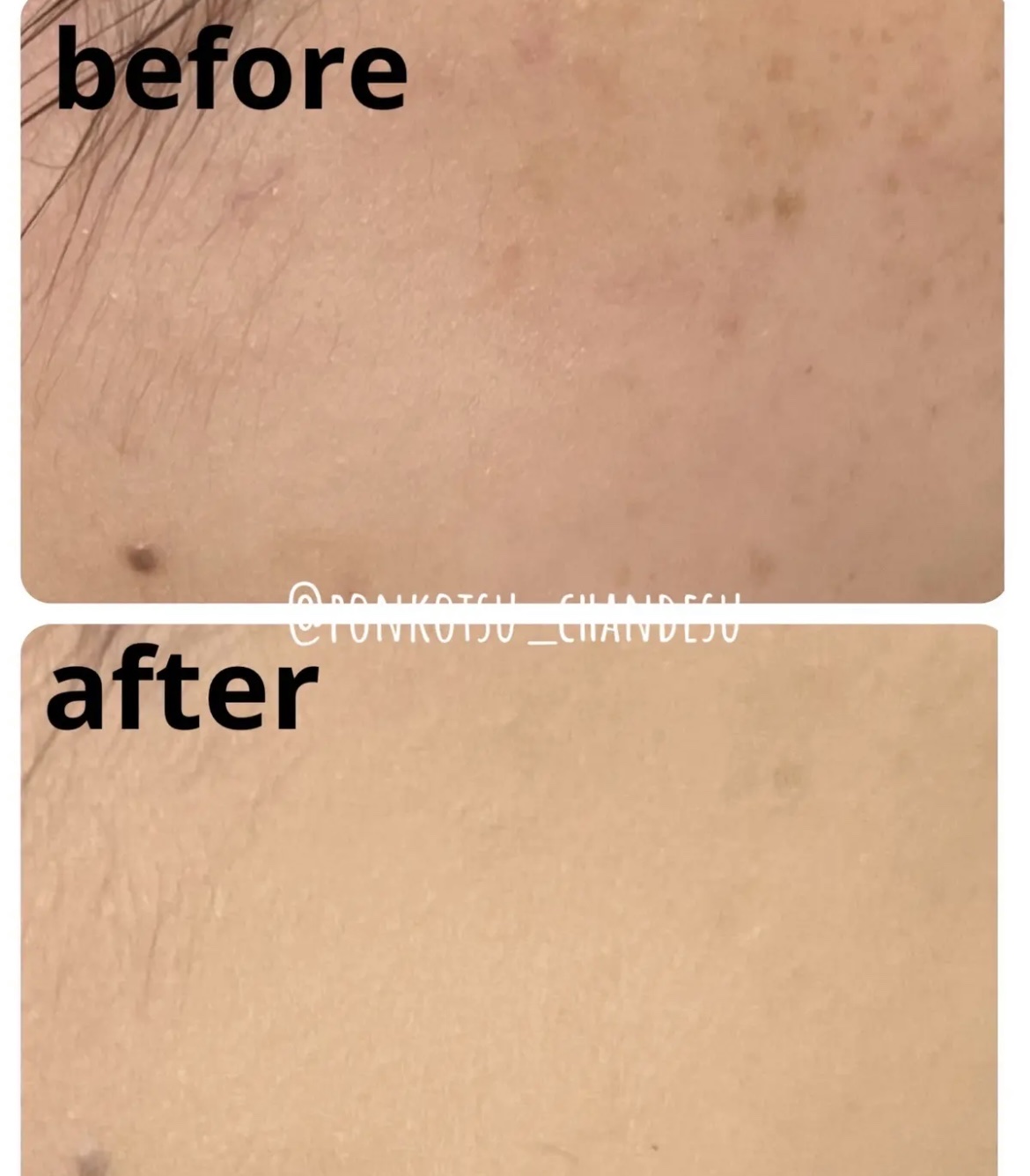 ミネラルUVパウダー/エトヴォス/ルースパウダーを使ったクチコミ（2枚目）