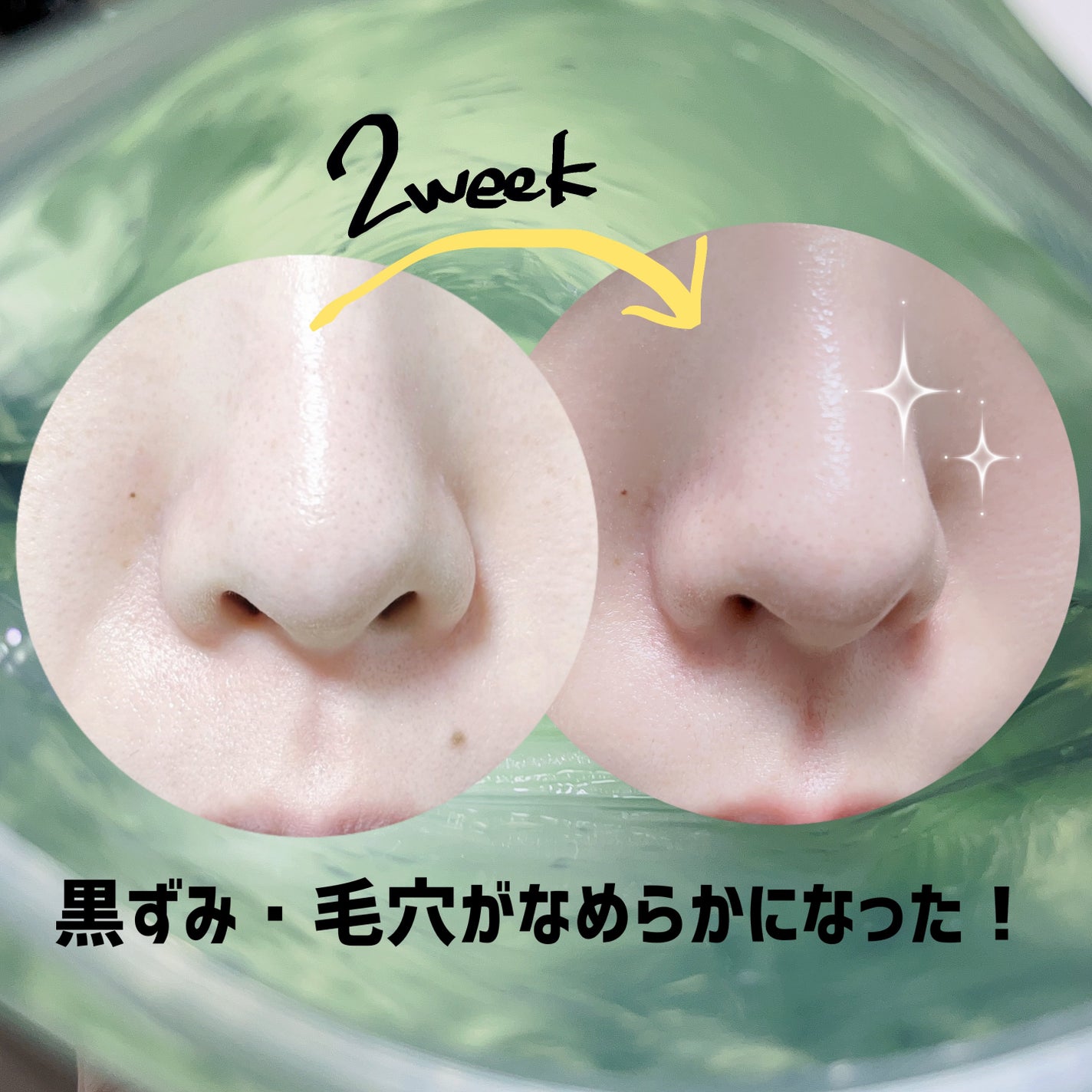 CICA エマルジョン/VT/乳液を使ったクチコミ(2枚目)