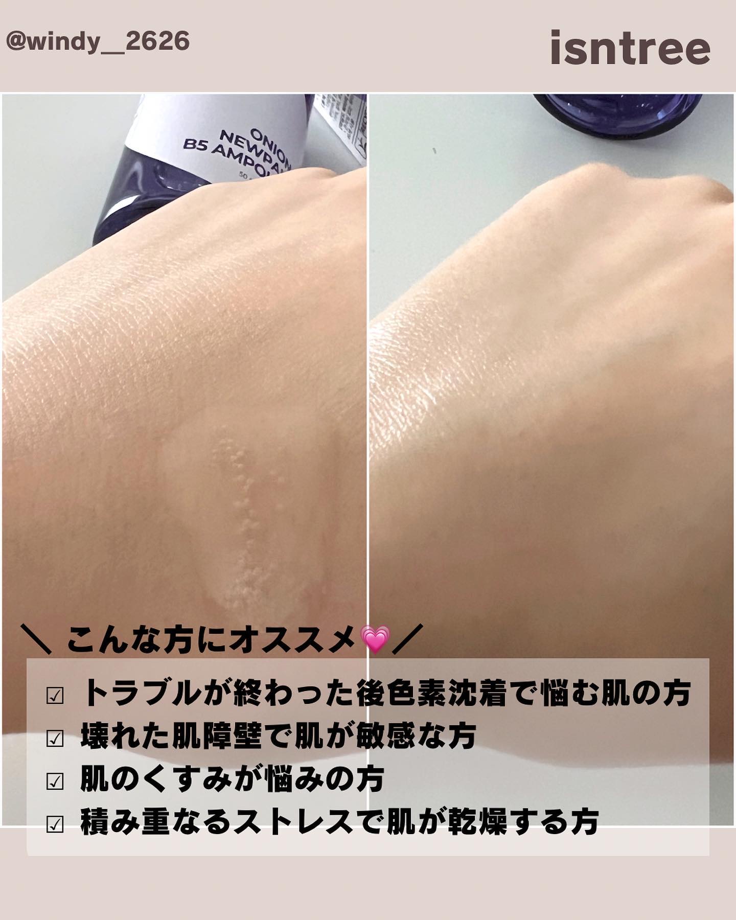 オニオンニューペア B5アンプル/Isntree/美容液を使ったクチコミ（3枚目）
