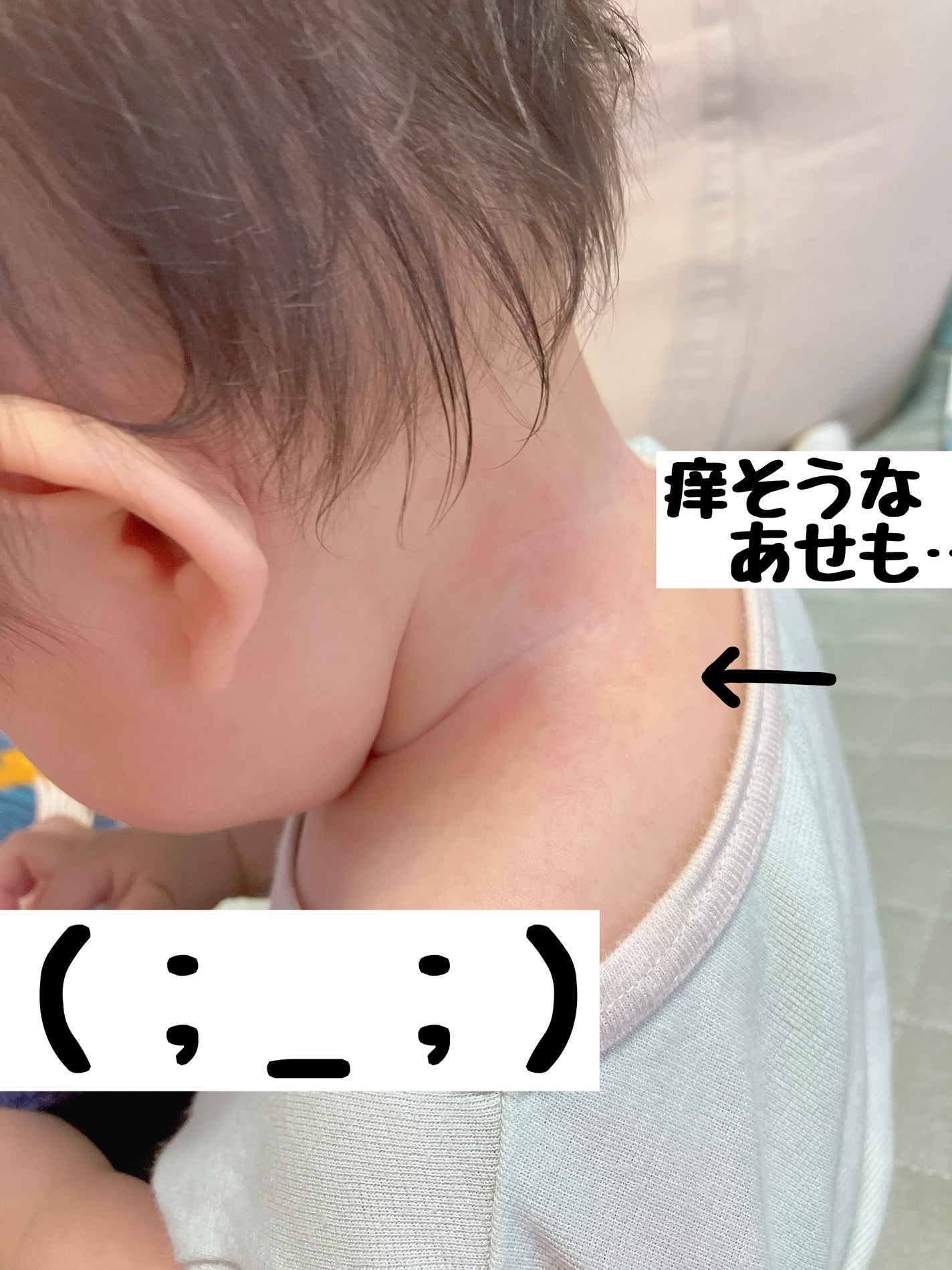 あせもクリーム(医薬品)/ユースキン/その他を使ったクチコミ(2枚目)