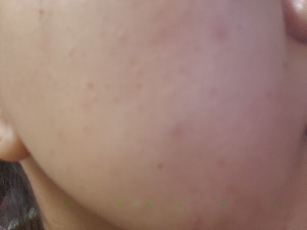 を使ったクチコミ（1枚目）