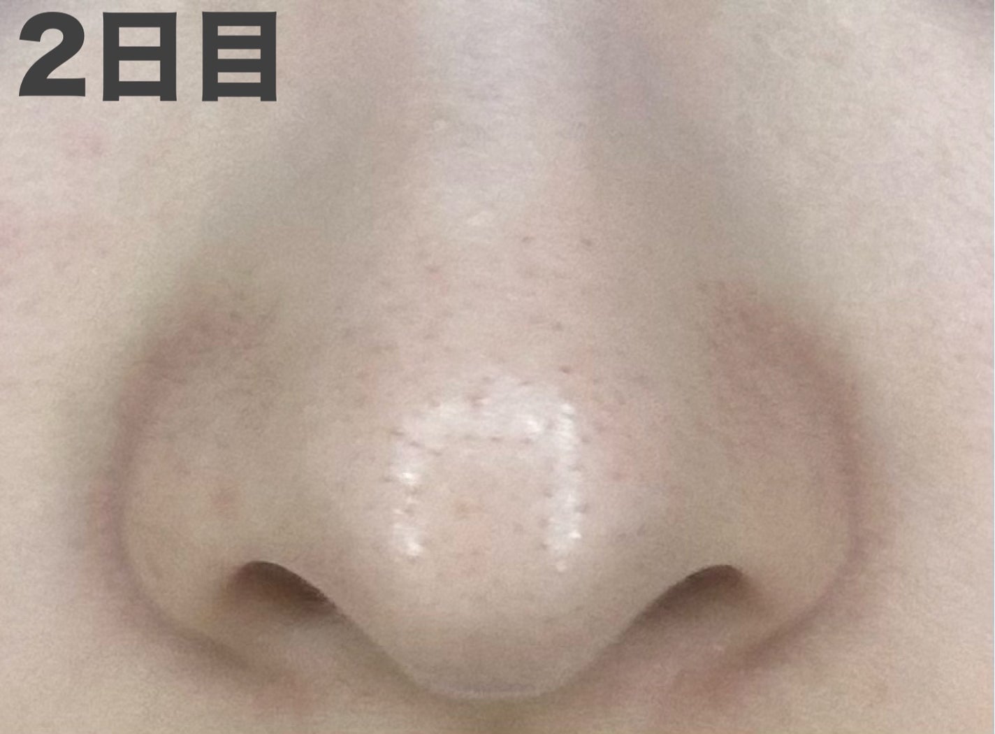 パーフェクトワンフォーカス スムースクレンジングバーム ディープブラック/PERFECT ONE FOCUS/クレンジングバームを使ったクチコミ(6枚目)