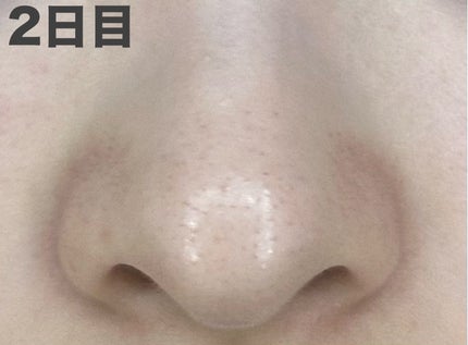 パーフェクトワンフォーカス スムースクレンジングバーム ディープブラック/PERFECT ONE FOCUS/クレンジングバームを使ったクチコミ(6枚目)