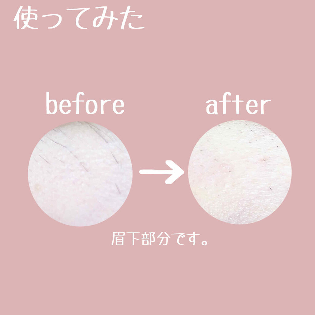 ニトリ フェイスシェイバー/ニトリ/シェーバーを使ったクチコミ（3枚目）