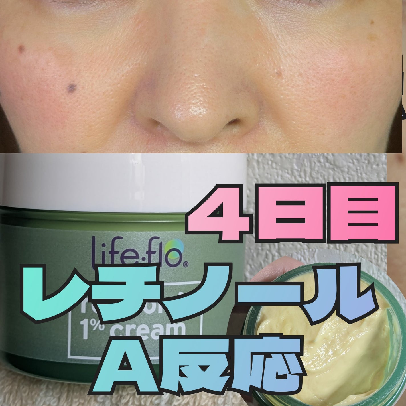 レチノールA 1% アドバンスドリバイタリゼーションクリーム/Life-flo/フェイスクリームを使ったクチコミ(1枚目)