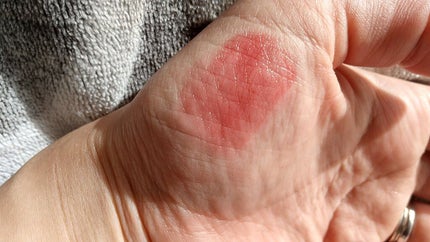 リップ&チーク ボーム N°1 ドゥ シャネル/CHANEL/口紅を使ったクチコミ(5枚目)