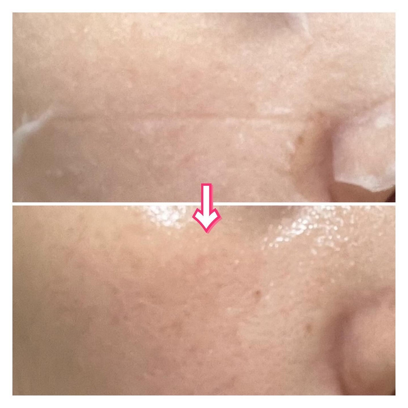 インテンスマルチコラーゲンムチンデイリーマスク/ネイチャーリパブリック/シートマスク・パックを使ったクチコミ(6枚目)