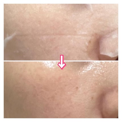 インテンスマルチコラーゲンムチンデイリーマスク/ネイチャーリパブリック/シートマスク・パックを使ったクチコミ(6枚目)