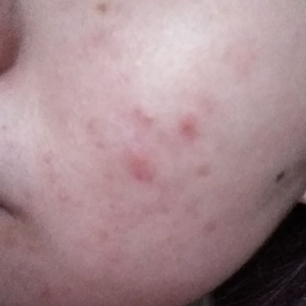 3種のヒアルロン酸配合 美容液/DAISO/美容液を使ったクチコミ（2枚目）