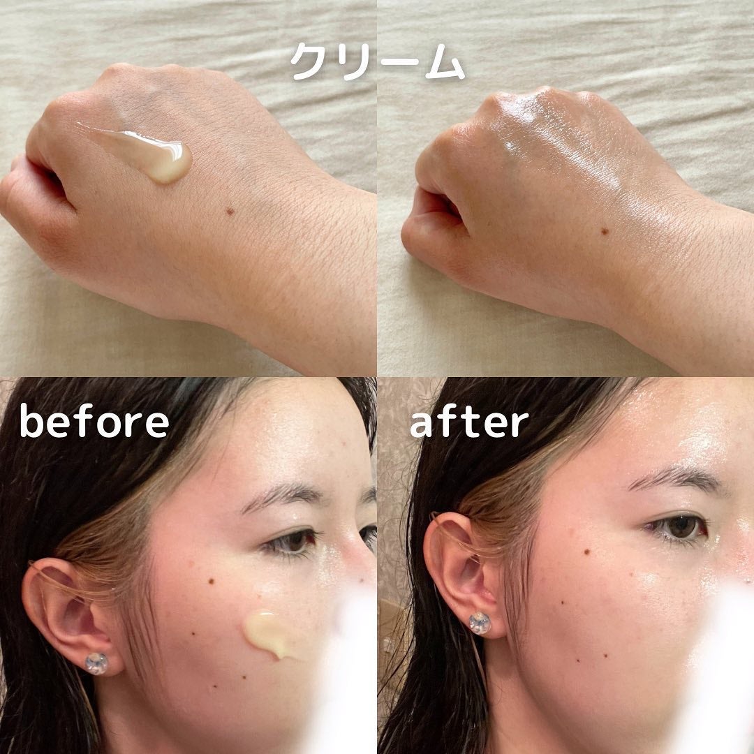 ユズナイアシンアンチブレミッシュセラム/SOME BY MI/美容液を使ったクチコミ(6枚目)