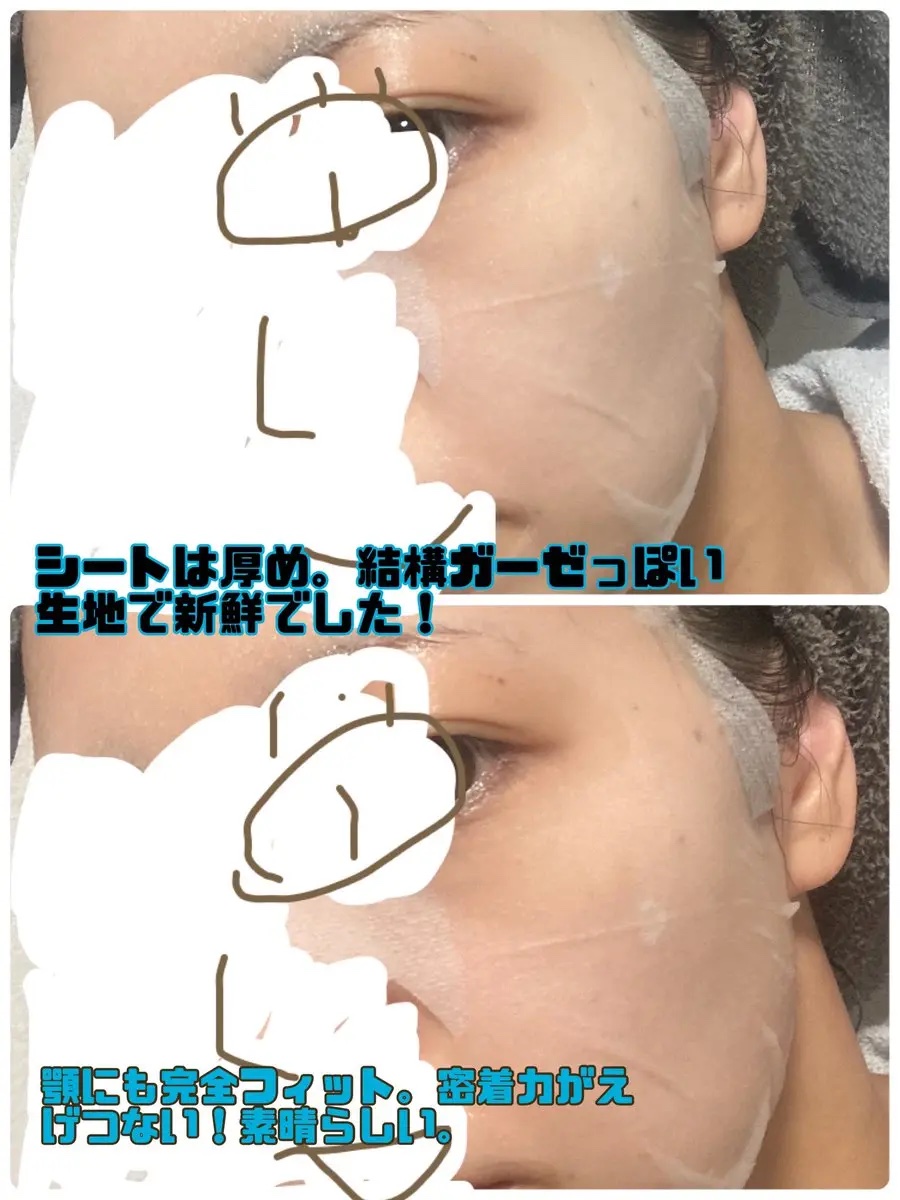 ヒト幹細胞フェイスマスク/アロヴィヴィ/シートマスク・パックを使ったクチコミ（2枚目）