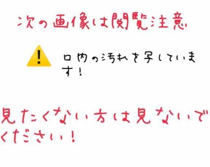 プロポリンス/プロポリンス/マウスウォッシュ・スプレーを使ったクチコミ(3枚目)