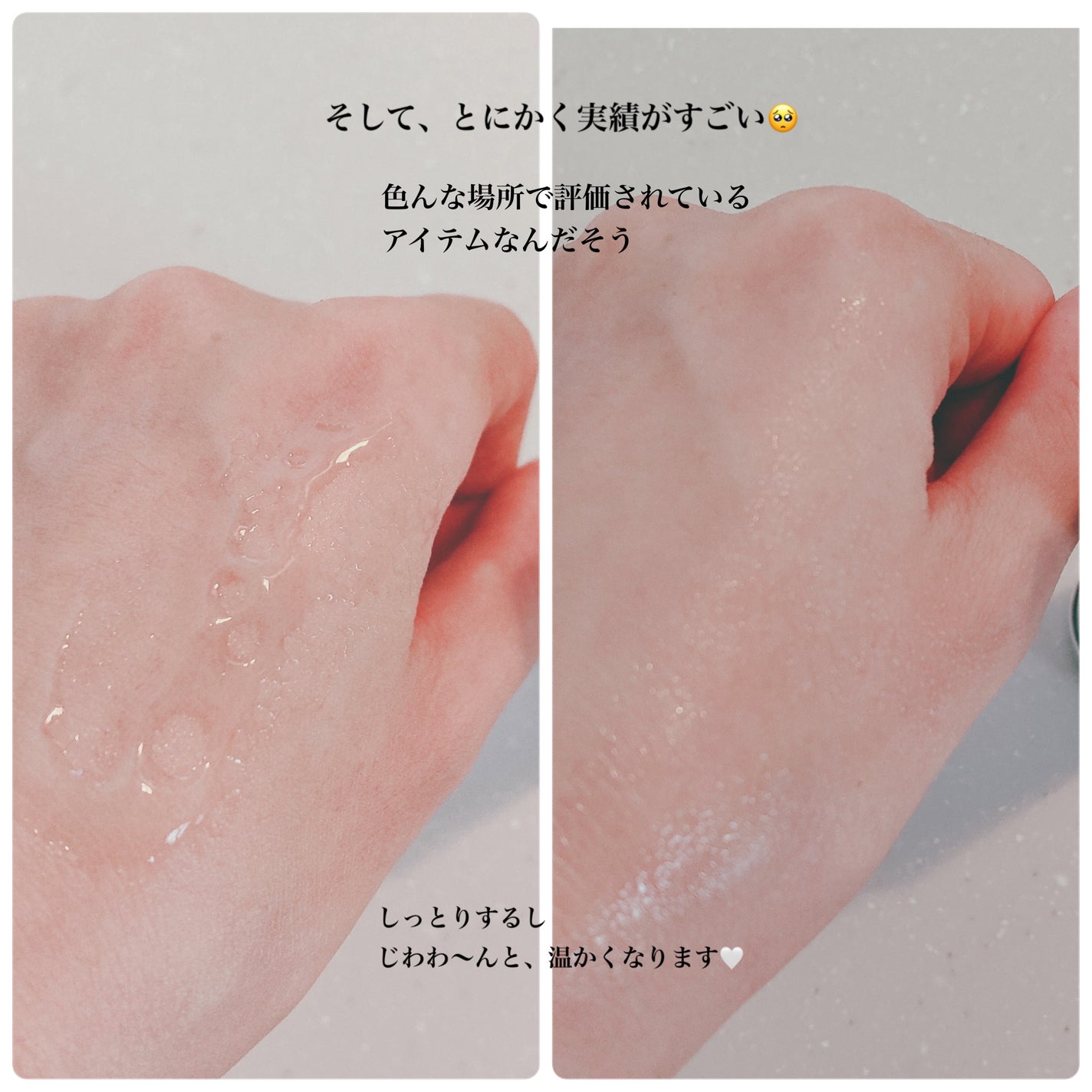 リペアジェル/リソウコーポレーション/美容液を使ったクチコミ(4枚目)