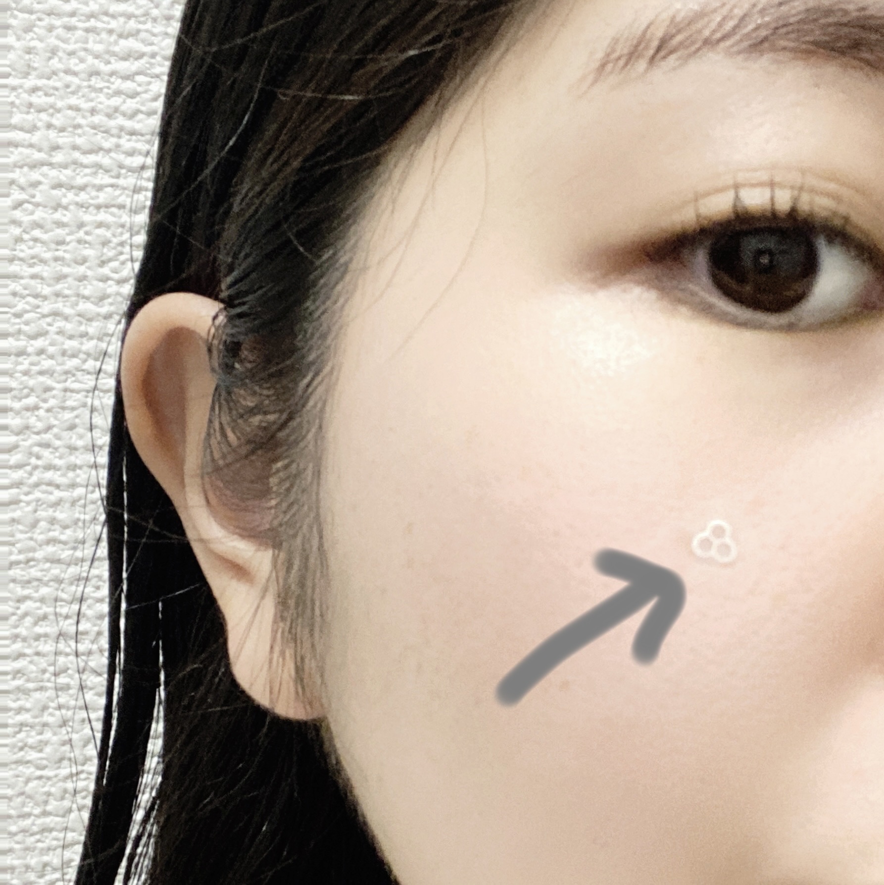 ACマグネシウムパッチ　ミニ/スノーツープラス/にきびパッチを使ったクチコミ（2枚目）