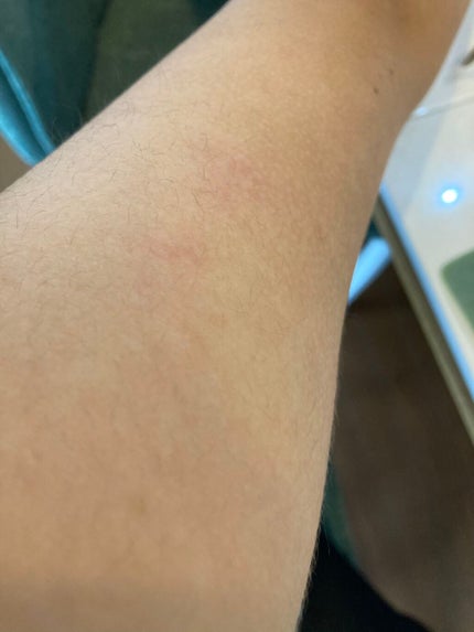 モテ肌 除毛パッド/セリア/ムダ毛ケアを使ったクチコミ(3枚目)