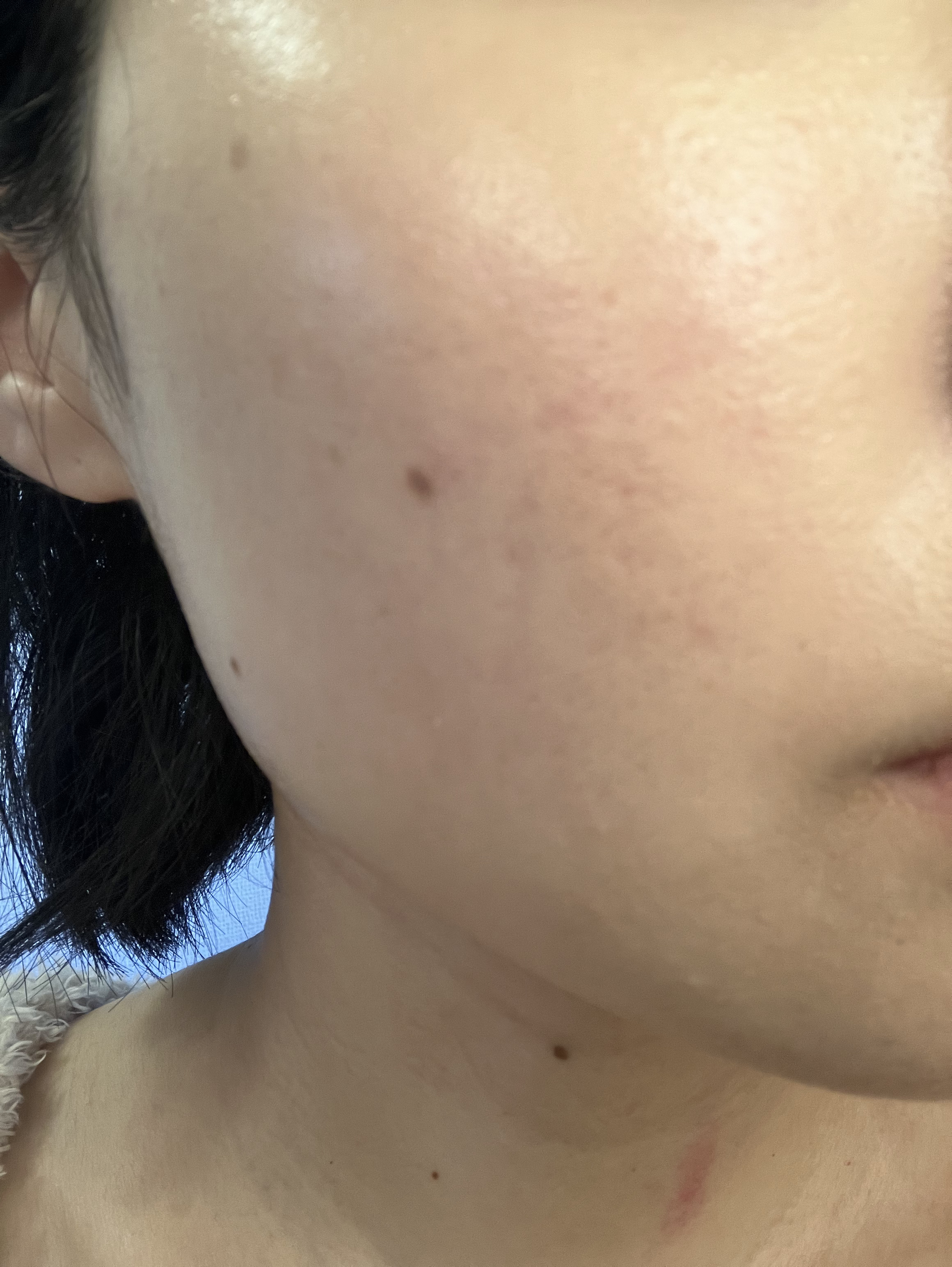 補中益気湯エキス錠クラシエ（医薬品）/クラシエ薬品/その他を使ったクチコミ（3枚目）