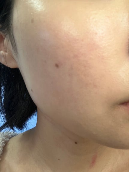 CO ホスピレッグ(機能性表示食品)/Co-medical+/健康サプリメントを使ったクチコミ(3枚目)