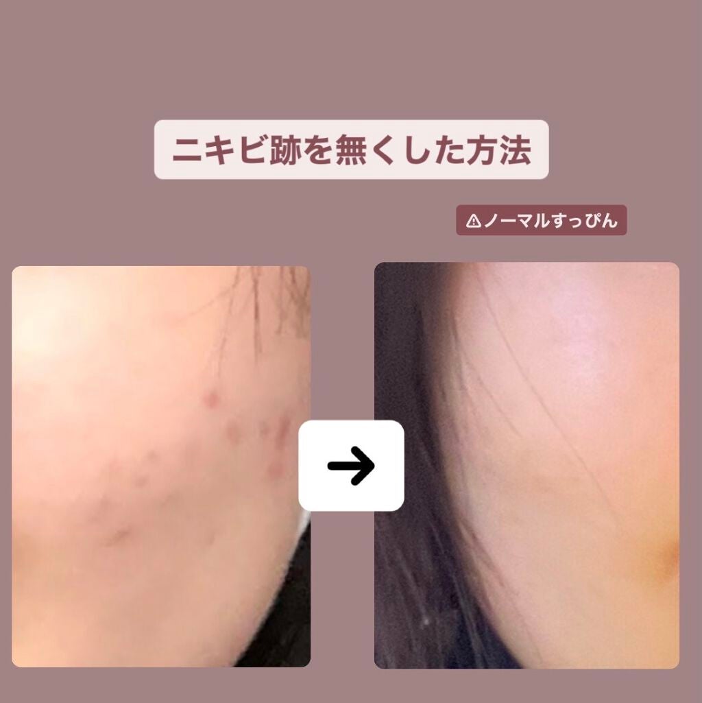 化粧水・敏感肌用・高保湿タイプ/無印良品/化粧水を使ったクチコミ(1枚目)