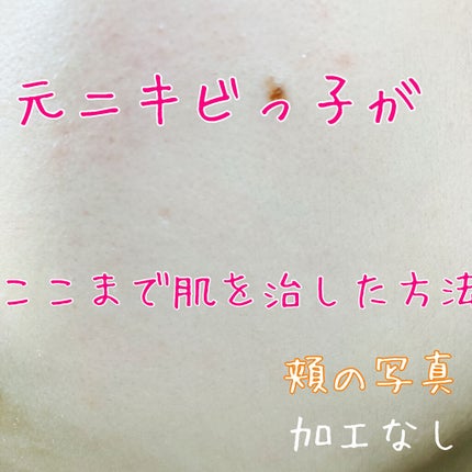 ノブ A アクネソープ/NOV/洗顔石鹸を使ったクチコミ(1枚目)