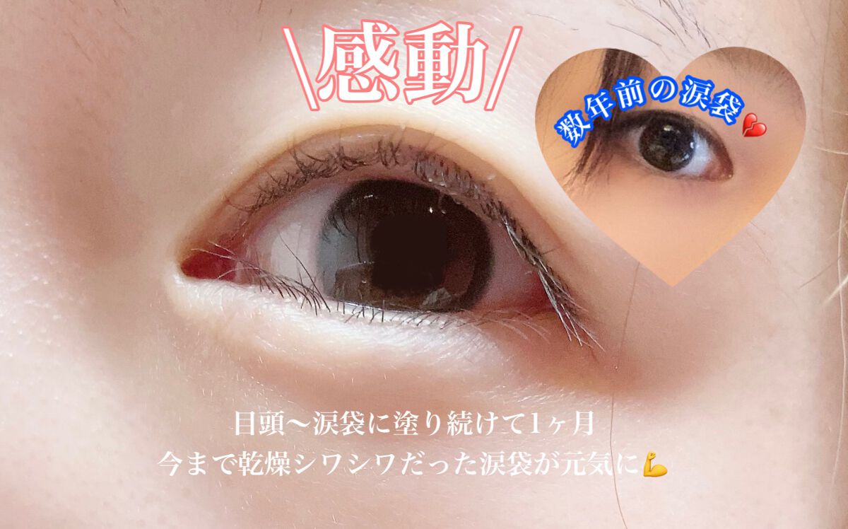 エリクシール シュペリエル エンリッチド リンクルクリーム/エリクシール/アイケア・アイクリームを使ったクチコミ（2枚目）