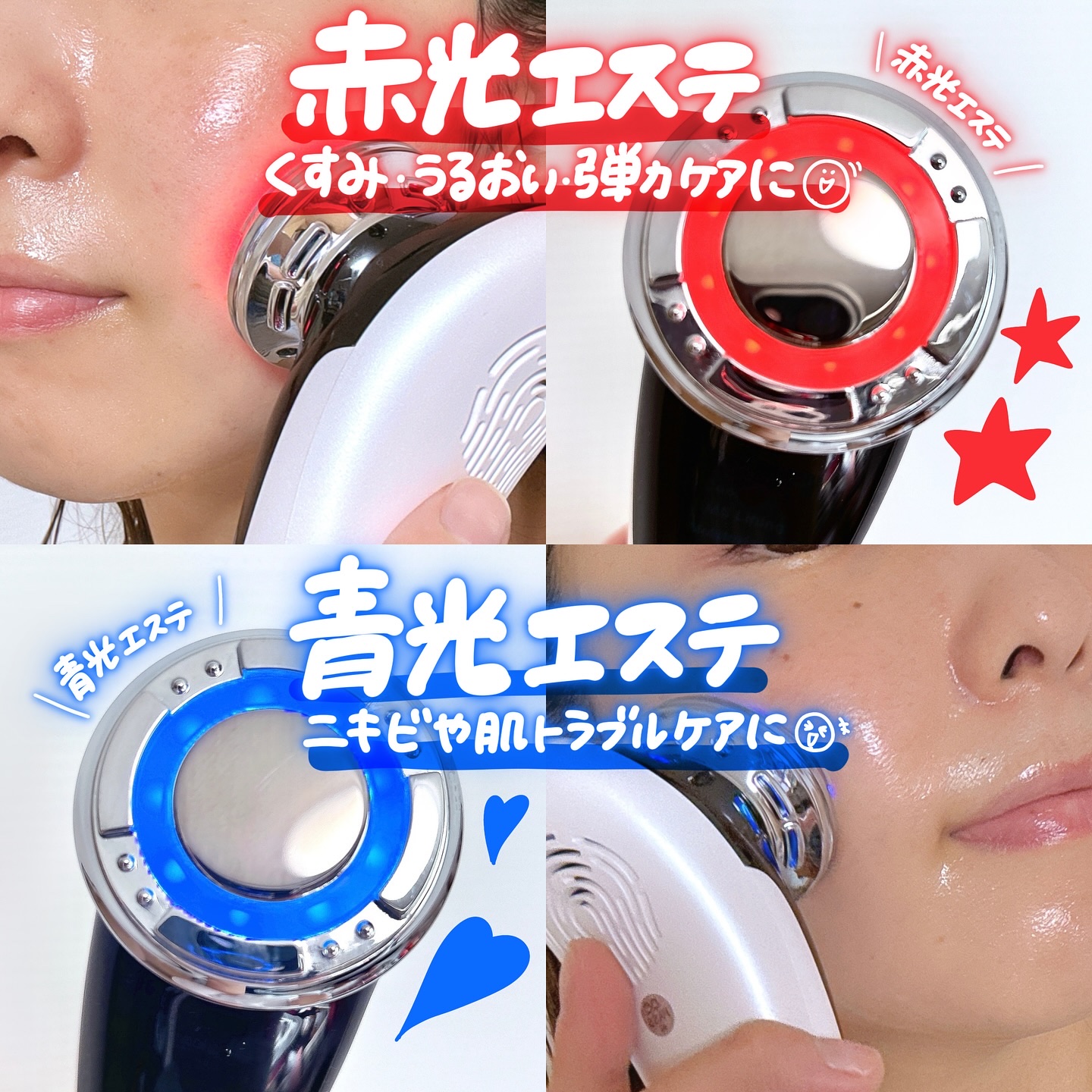 多機能温冷美顔器/ANLAN/美顔器・マッサージを使ったクチコミ（3枚目）