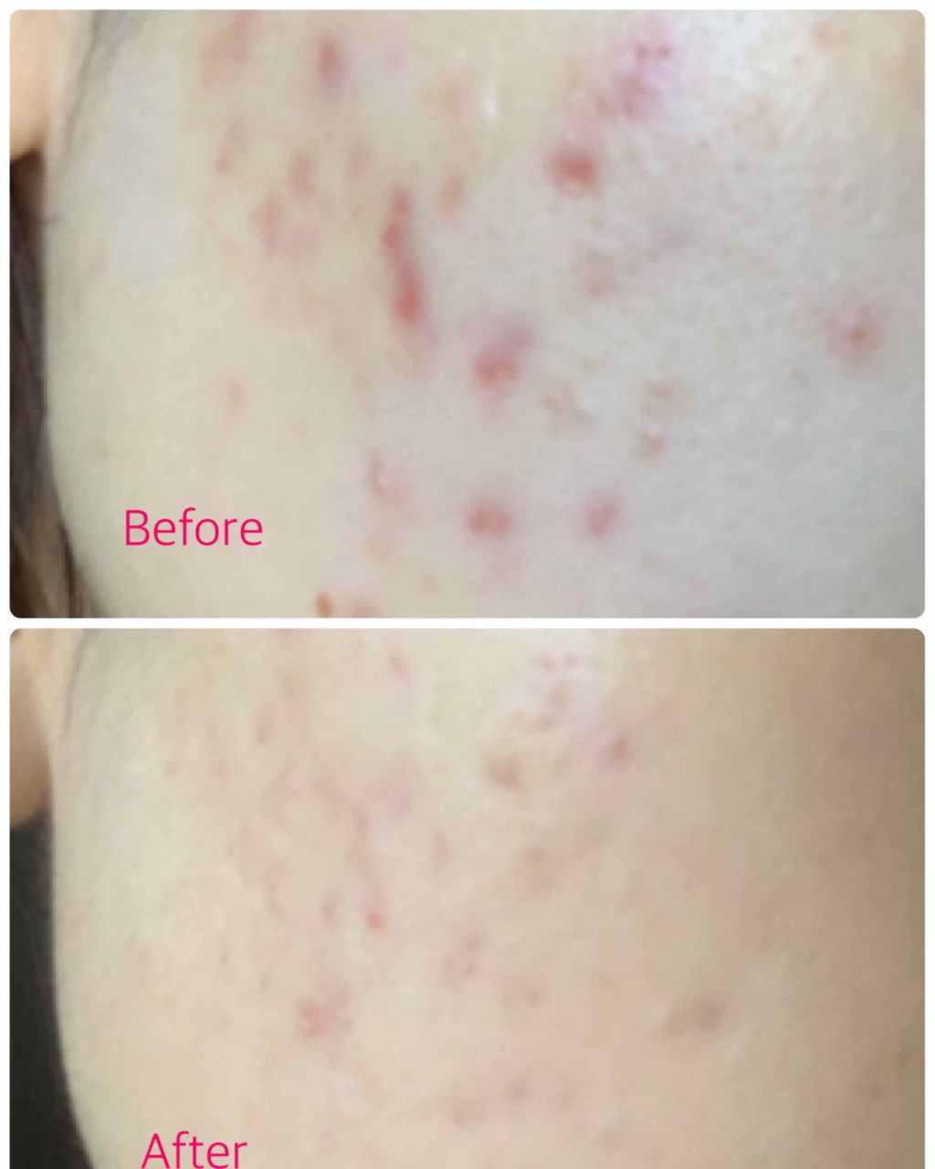 乳液・敏感肌用・高保湿タイプ/無印良品/乳液を使ったクチコミ(2枚目)