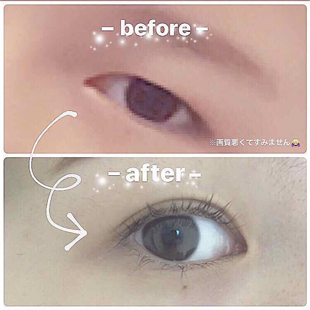 アイトーク/アイトーク/二重まぶた用アイテムを使ったクチコミ(1枚目)