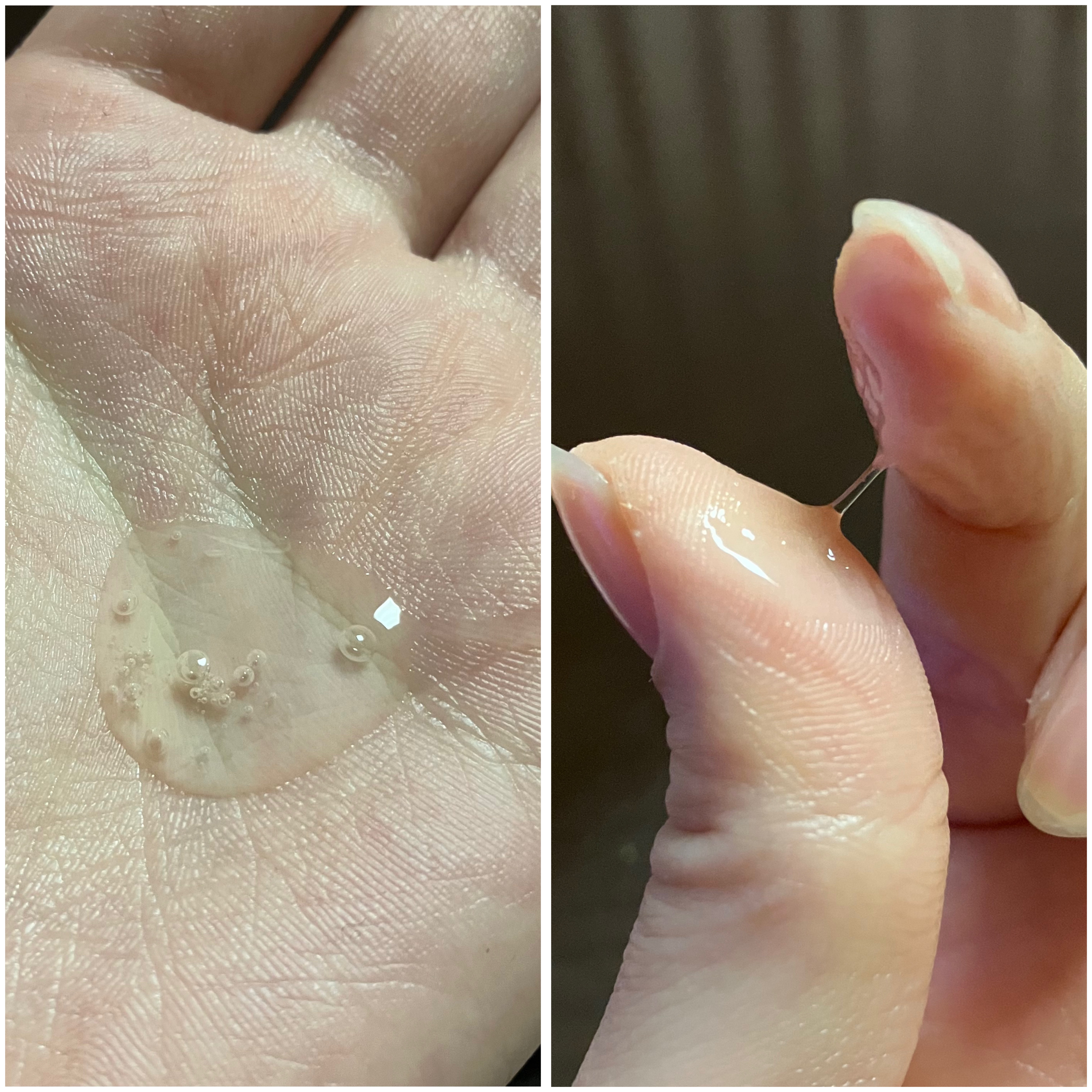 グルカミューンクリーム/VT/フェイスクリームを使ったクチコミ（3枚目）