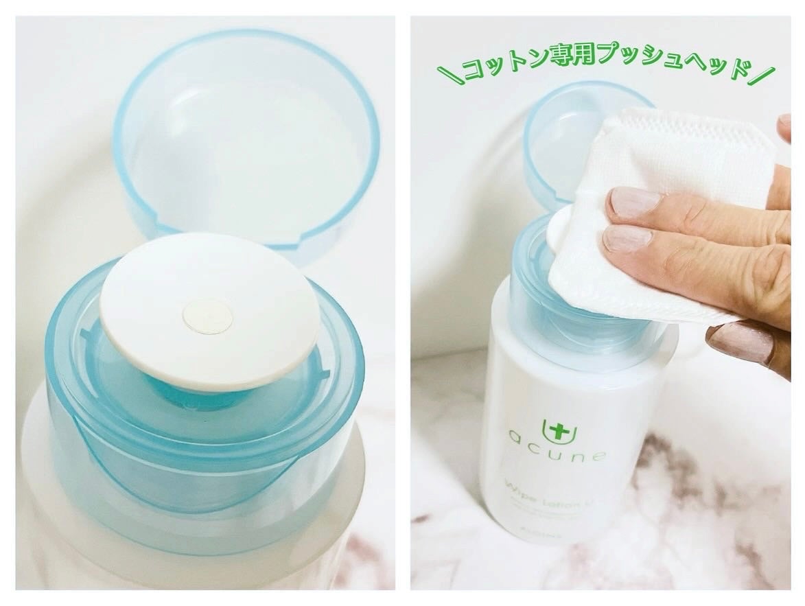 アキュネ 薬用ふきとりローションU/アキュネ/拭き取り化粧水を使ったクチコミ(2枚目)