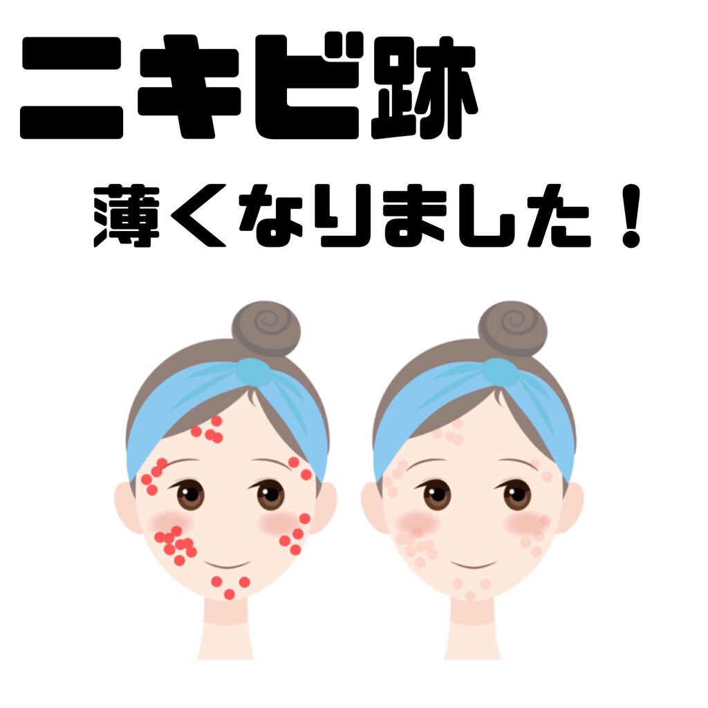 わたしの垢抜け方法 話題沸騰中のコスメ 真似したいメイク方法の口コミが50件 デパコスからプチプラまで Lips