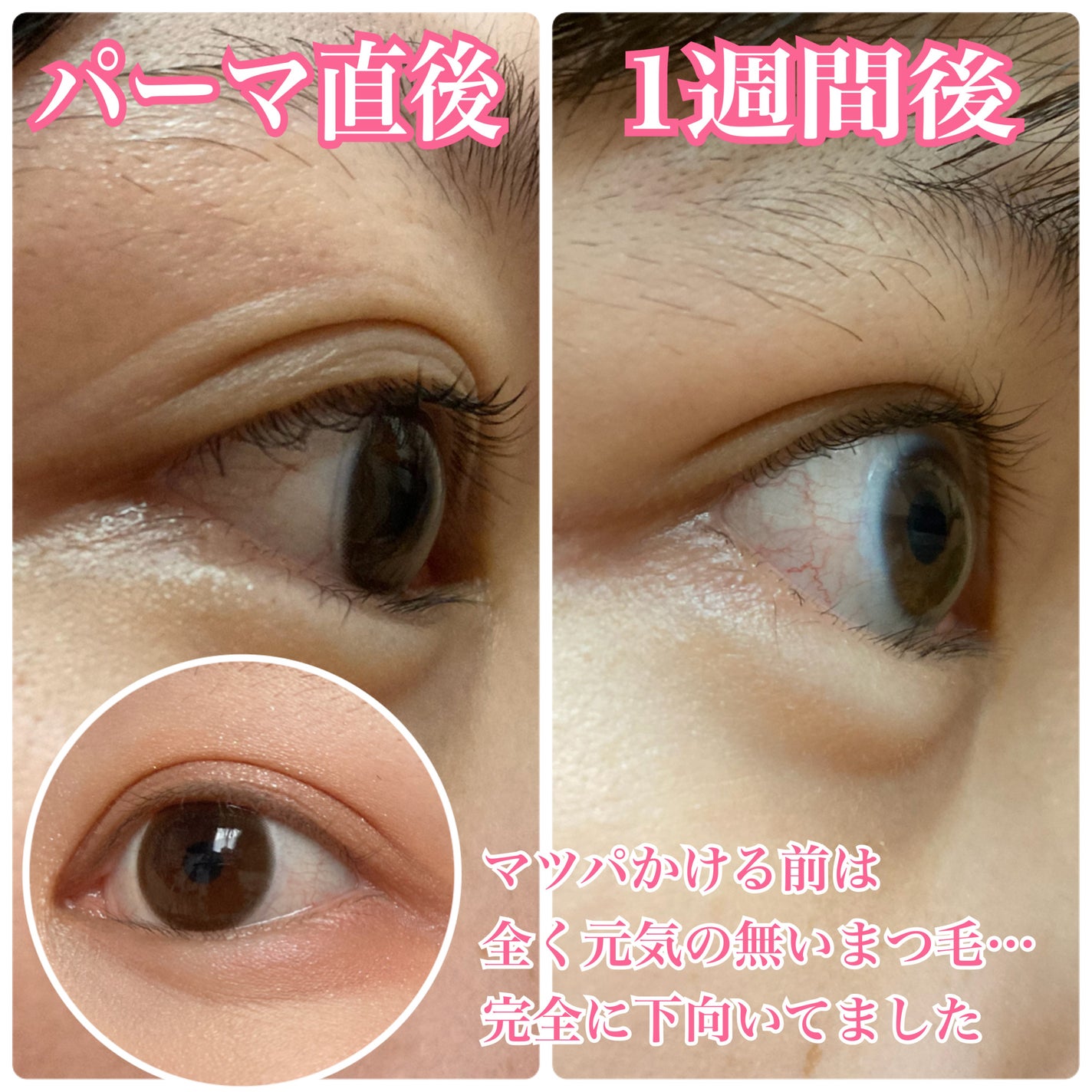 パーマイットアップアイラッシュパーマキット/Loingz/その他キットセットを使ったクチコミ(6枚目)