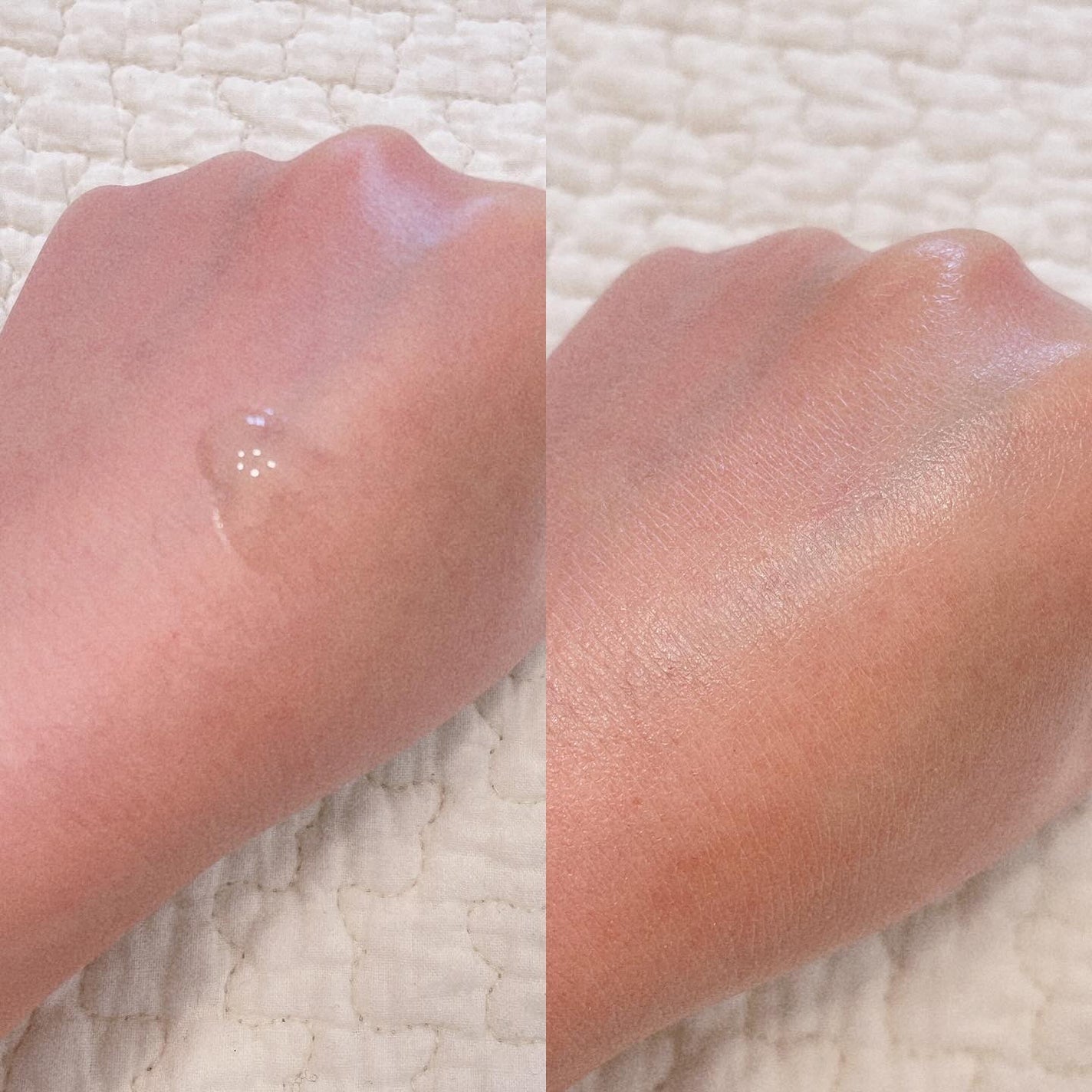 グリーンカーミングセラムミスト/Free Moment /ミスト状化粧水を使ったクチコミ(3枚目)