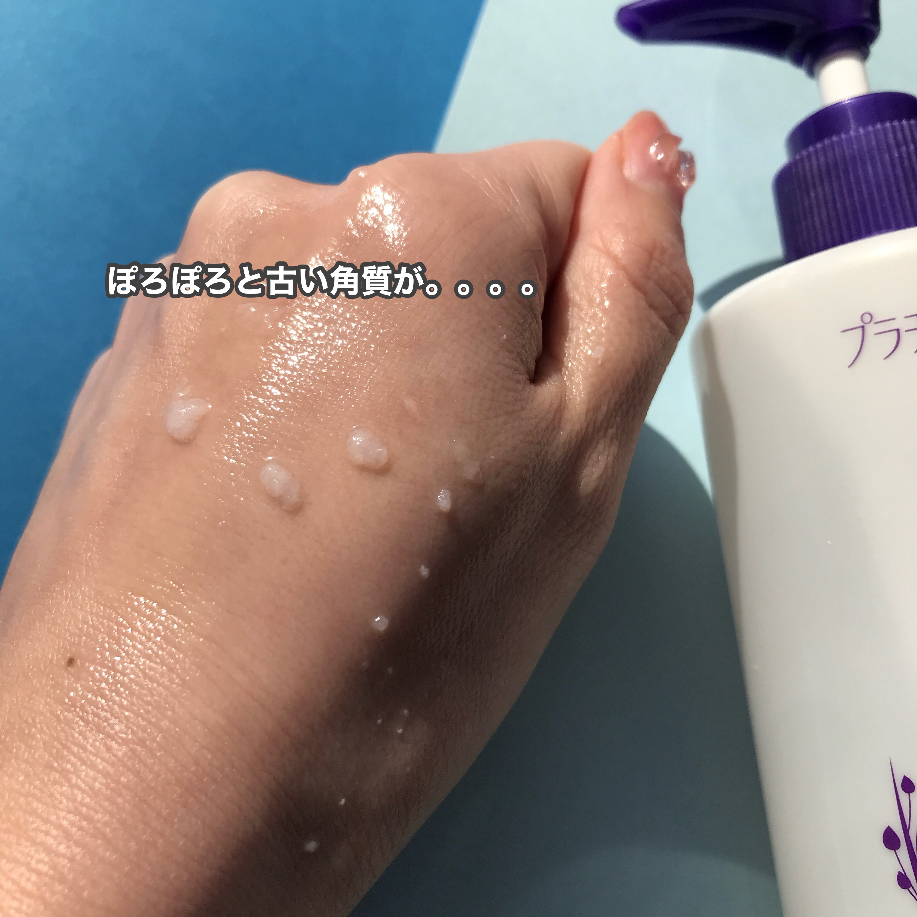 ハトムギエキスピーリングジェル/プラチナレーベル/ピーリングを使ったクチコミ（3枚目）