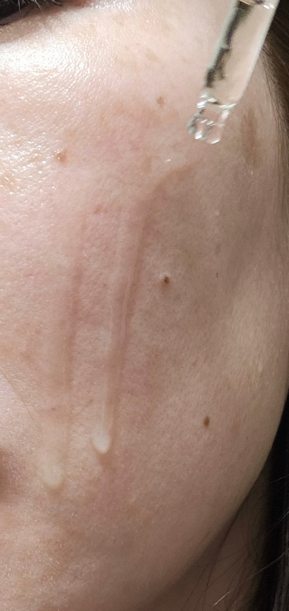 センテラ アンプル/SKIN1004/美容液を使ったクチコミ(3枚目)