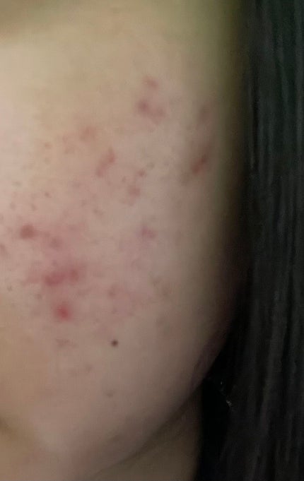 白潤プレミアム薬用浸透美白化粧水/肌ラボ/化粧水を使ったクチコミ(3枚目)