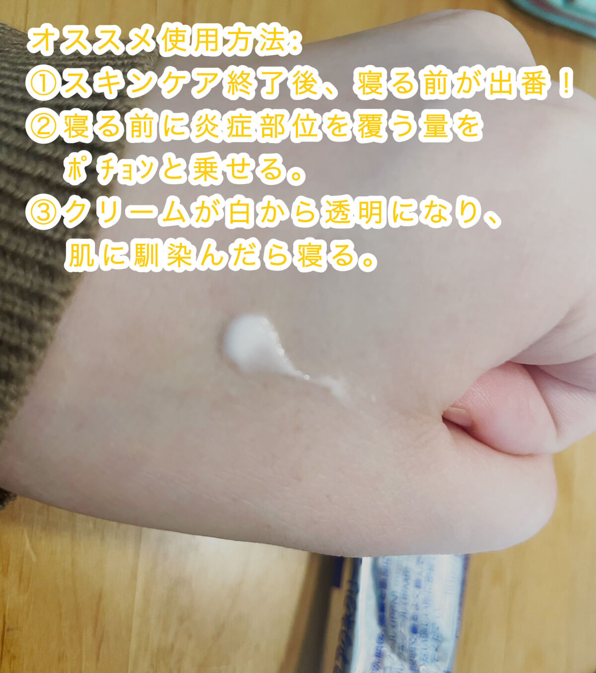 ペアアクネクリームW(医薬品)/ペア/その他を使ったクチコミ（2枚目）