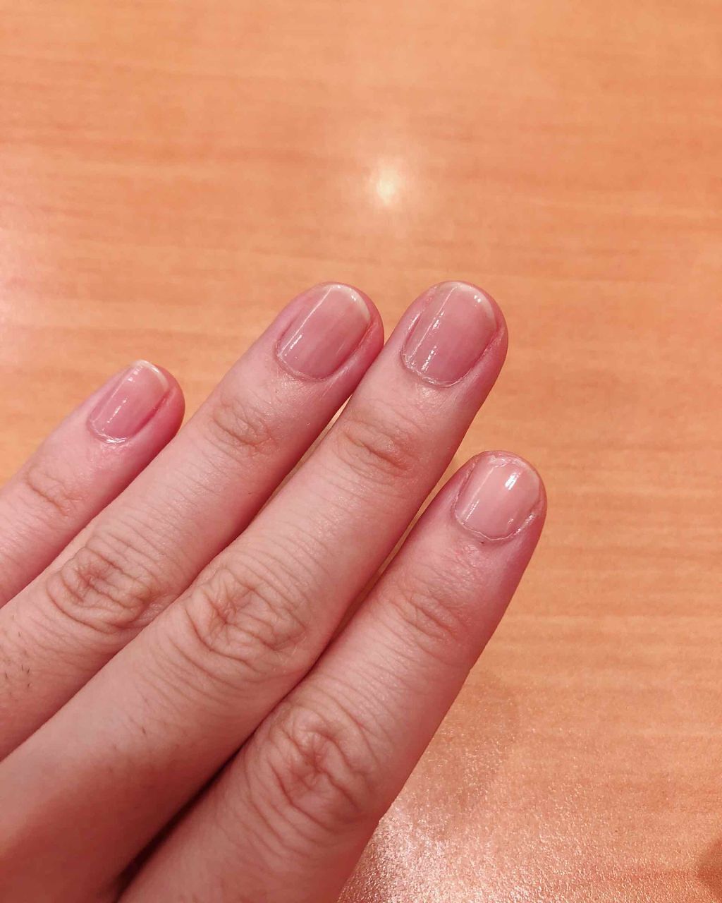 オールインケアコート/ネイリスト/オールインワンネイルを使ったクチコミ（2枚目）