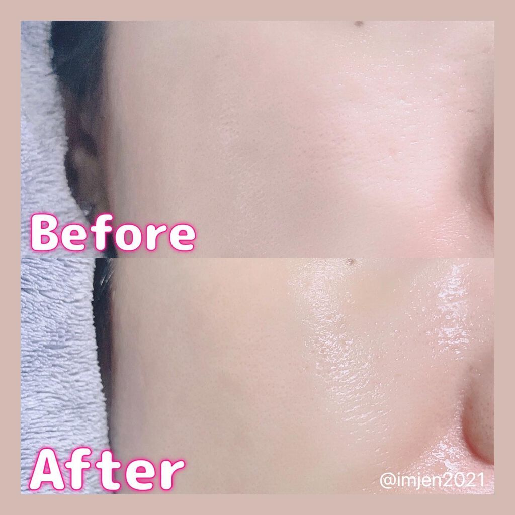 カワラヨモギ90カーミングアンプル/RE:GET/美容液を使ったクチコミ(4枚目)