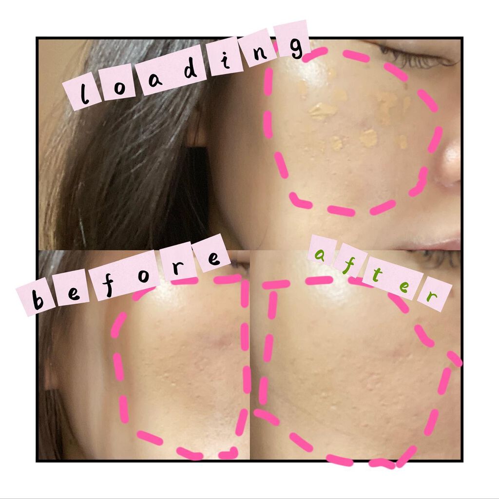 モイストラボ エッセンス薬用美白コンシーラー ナチュラルオークル03/Moist Labo/リキッドコンシーラーを使ったクチコミ（2枚目）