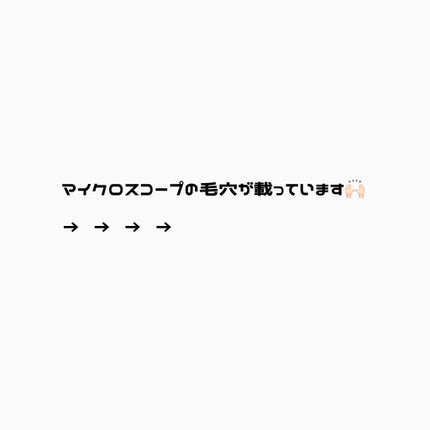 毛穴すっきりパック 鼻用 白色タイプ/ビオレ/その他スキンケアを使ったクチコミ(2枚目)