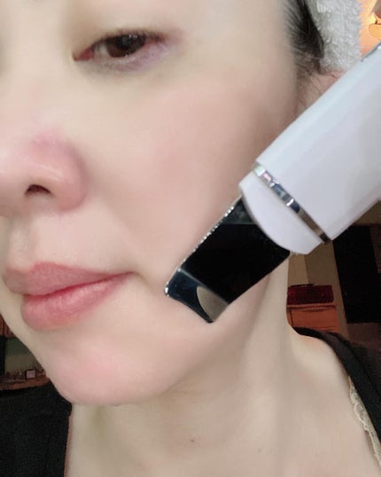 ウォーターピーリング超音波美顔器/ANLAN/美顔器・マッサージを使ったクチコミ(5枚目)