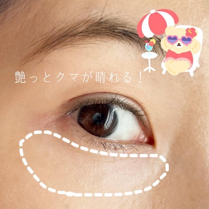 ごめんね素肌 クマらないアイクリーム/クリアターン/アイケア・アイクリームを使ったクチコミ(5枚目)