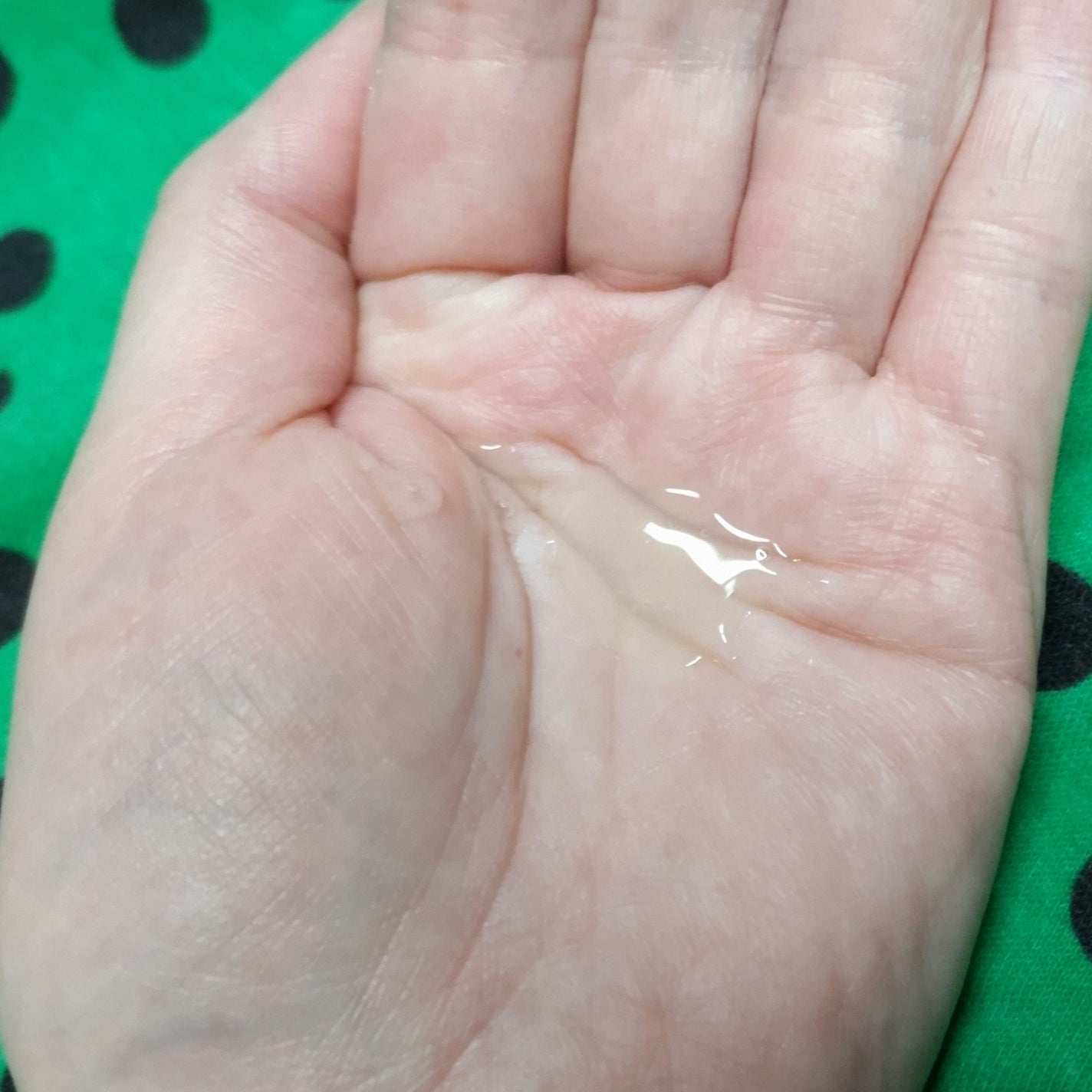 ラグジュアリーホワイト 薬用アクティブクリアD/アンプルール/美容液を使ったクチコミ(4枚目)