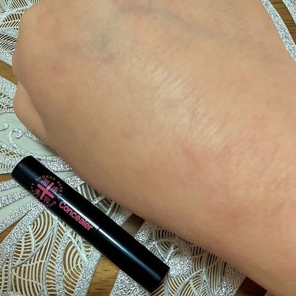 湘南美容コンシーラー/湘南美容/スティックコンシーラーを使ったクチコミ(10枚目)